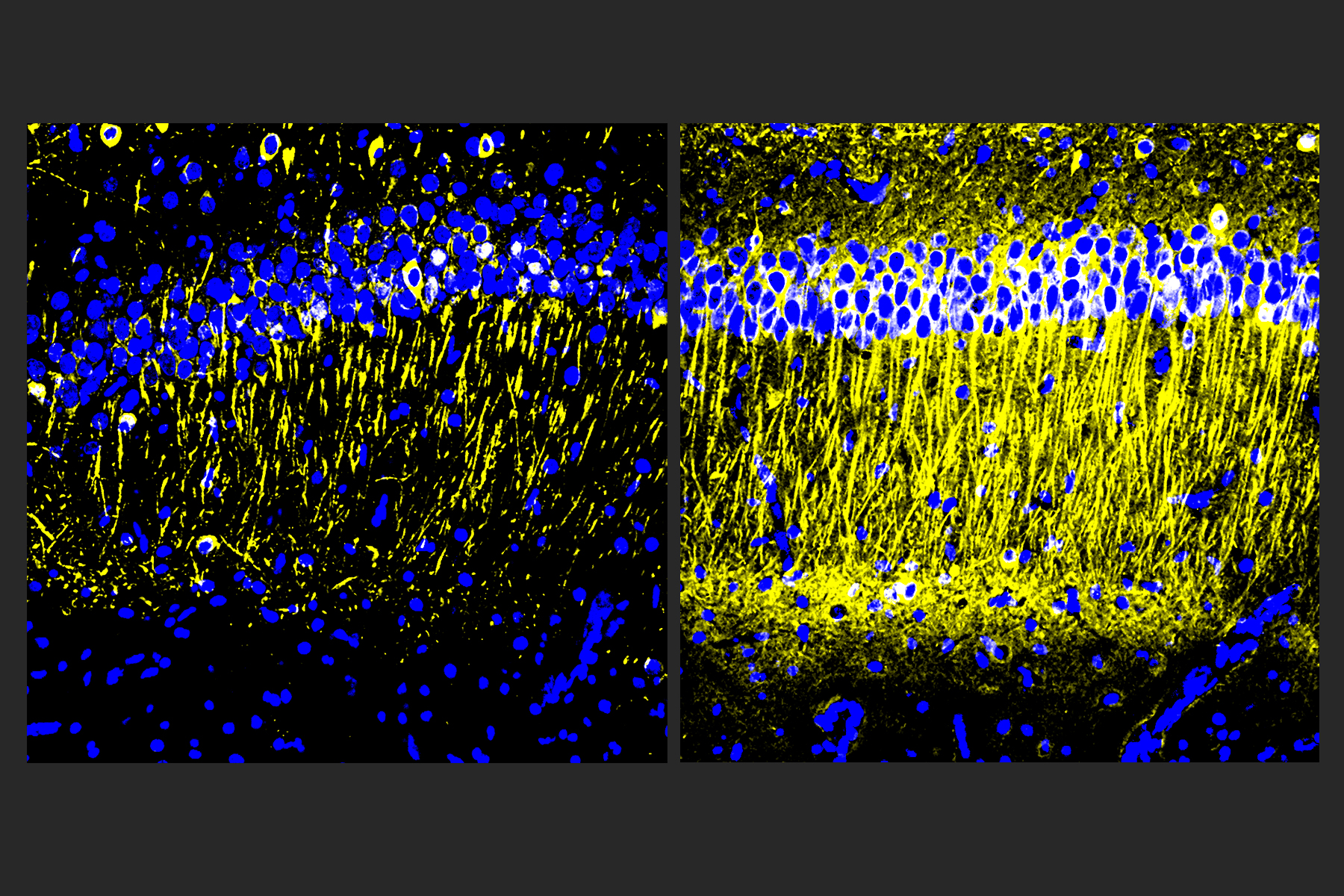 Two square panels side by side show a stripe of many blue dots near the top. The panel on the left has a few yellow stripes extending down from the blue dots. The panel on the right has many more of the yellow vertical lines.