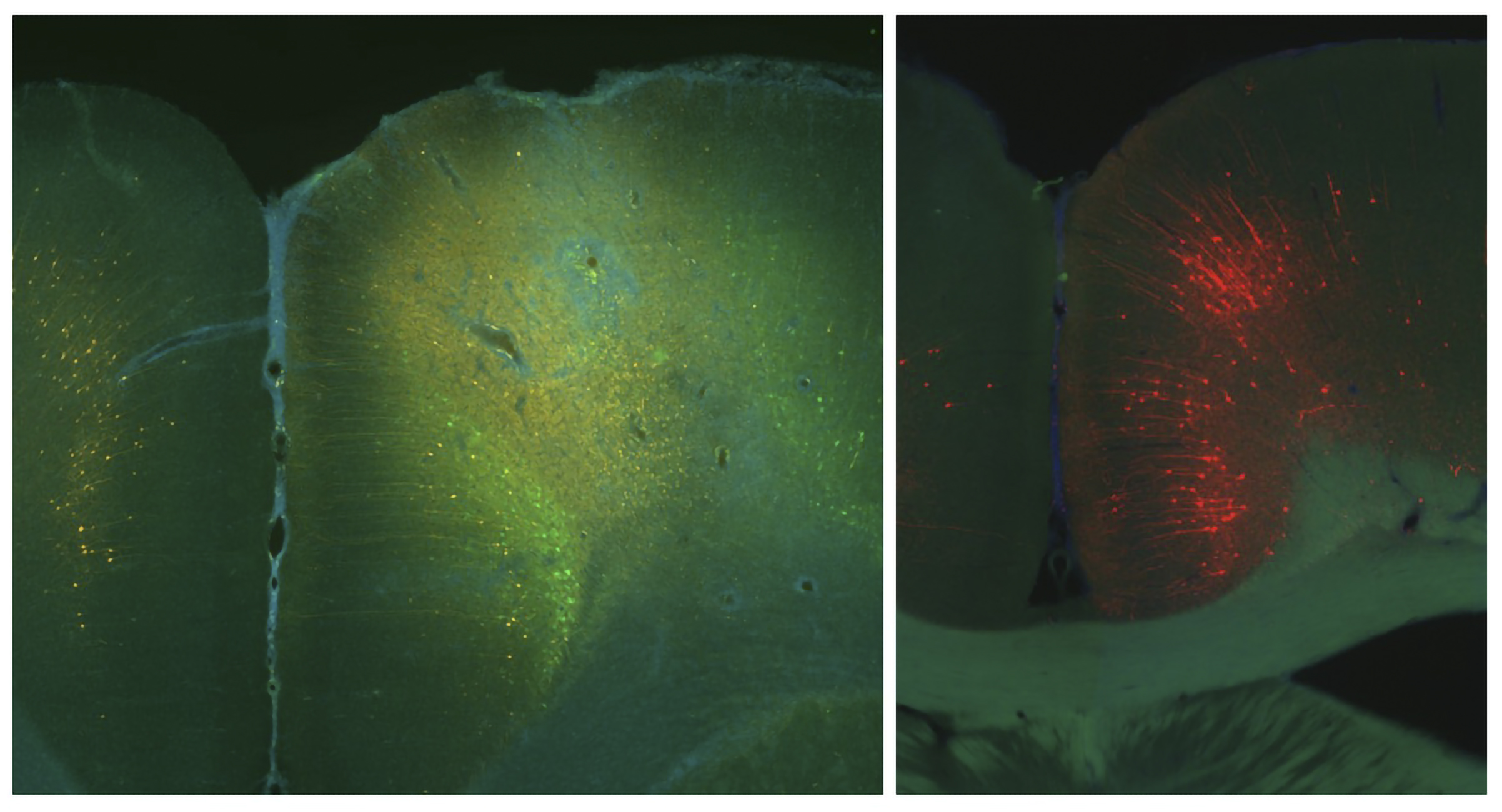 Two black panels on a white background show sections of brain. One glows with neurons colored green. The other panel glows with neurons colored red.