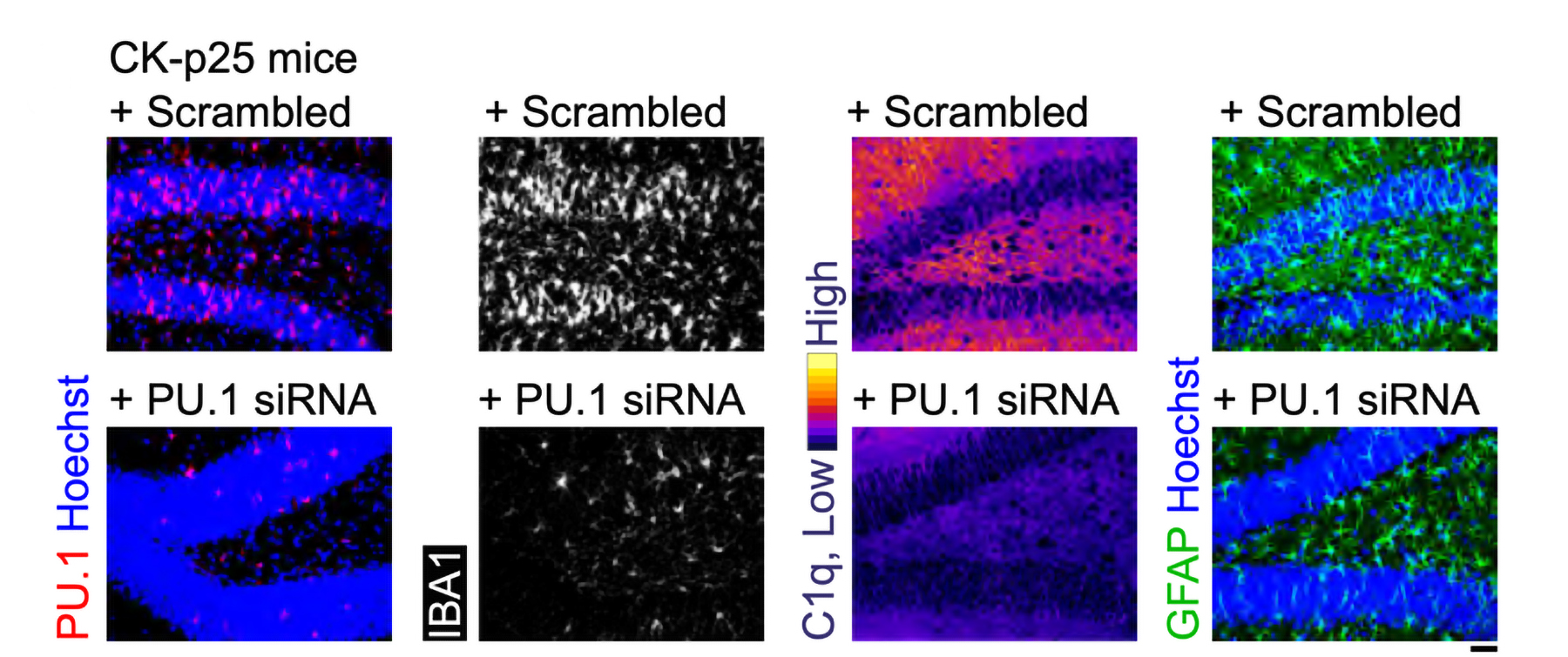 Nanoparticle-delivered RNA reduces neuroinflammation in lab tests