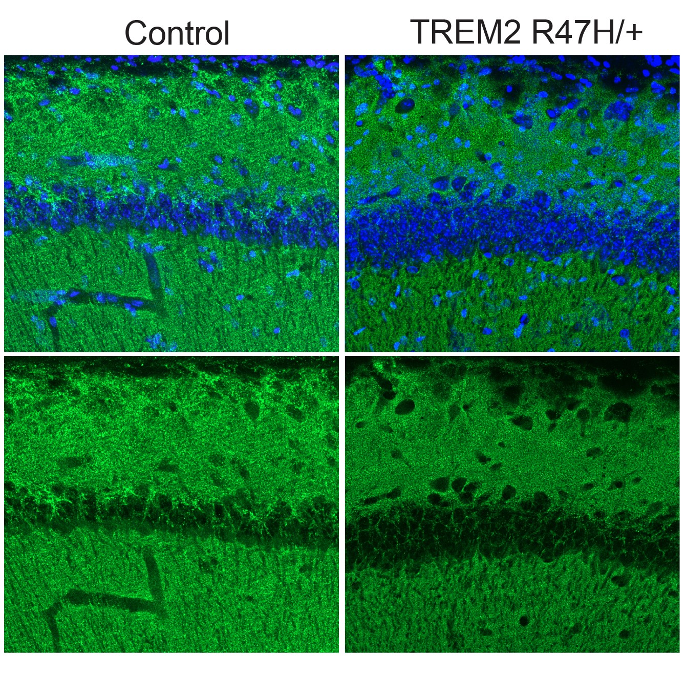 Four panels in a 2X2 grid show stained sections of a mouse hippocampus. The green staining in the column on the left glows brighter than the green staining in the column on the right.