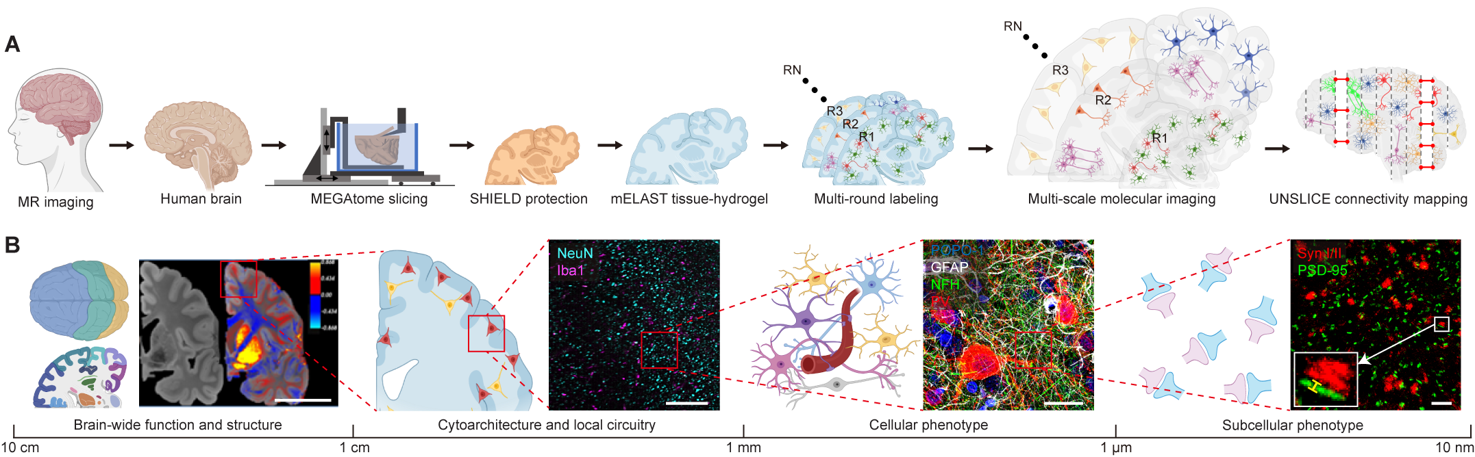 A figure from the research paper shows the workflow of brain tissue scanning along the top and then samples of that work along the way on the bottom. Sample images show brain tissue at full hemisphere scale, then at a broad circuit level, then down to single cells and then individual synapses.