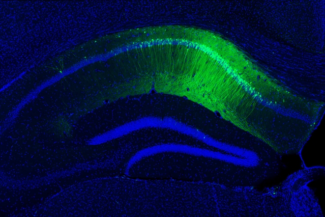 A hippocampal slice with green neurons representing a memory engram