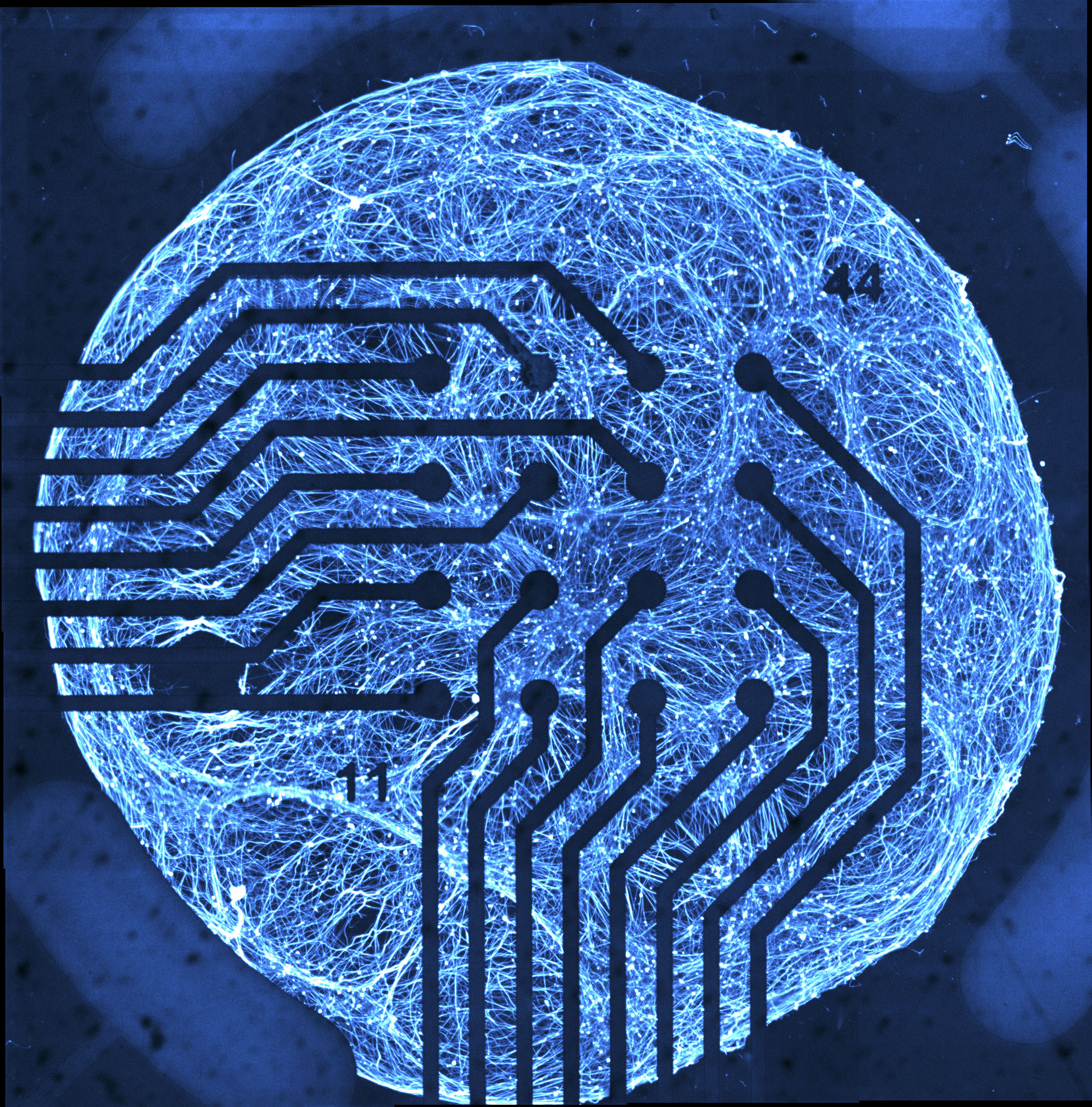 A ball of electric blue tangly cells is overlaid by the siilhouette of an array of long wires that terminte in little round balls