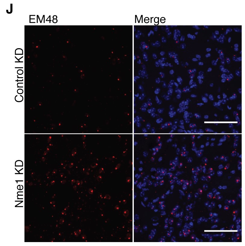 A 2x2 grid of microscop images shows red speckles overlaid on blue blobs. The blue indicates cells. The red indicates aggregated proteins. Where a gene called NME has been knocked down, there are more red speckles on the cells.