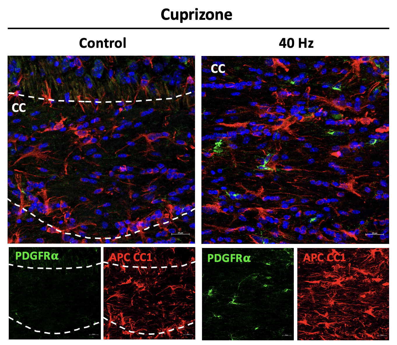 Study reveals ways in which 40Hz sensory stimulation may preserve brain’s ‘white matter’