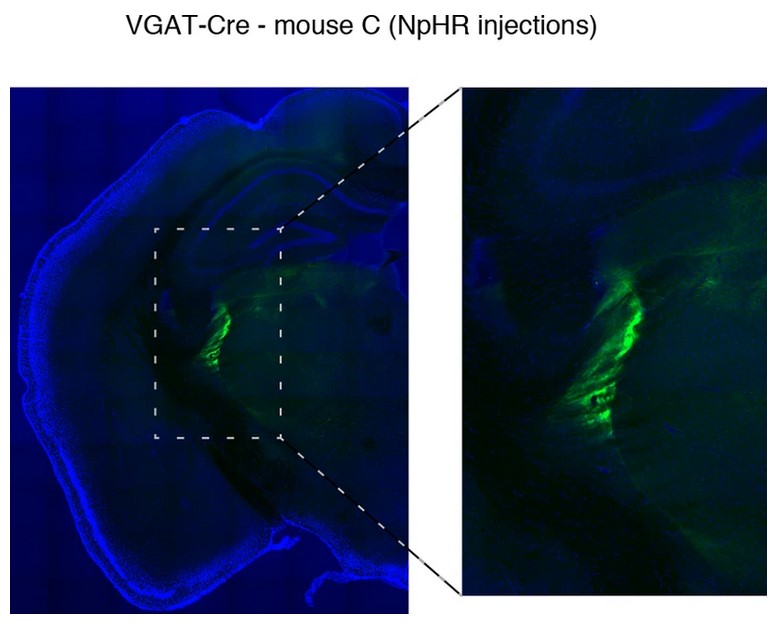 Two panels show a large blue area of brain tissue with a green stain in the middle. The green stain is enlarged ont he wright showing where an experimental injection occurred.