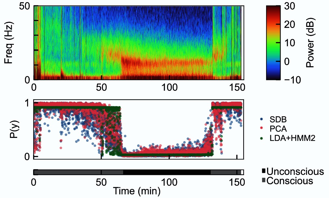 A rectangle along the top uses colors to show the power of different frequencies of brain rhythms at different times. A bottom rectangle uses the height of dots to show how algorithms judged the probability of consciousness at those same times.