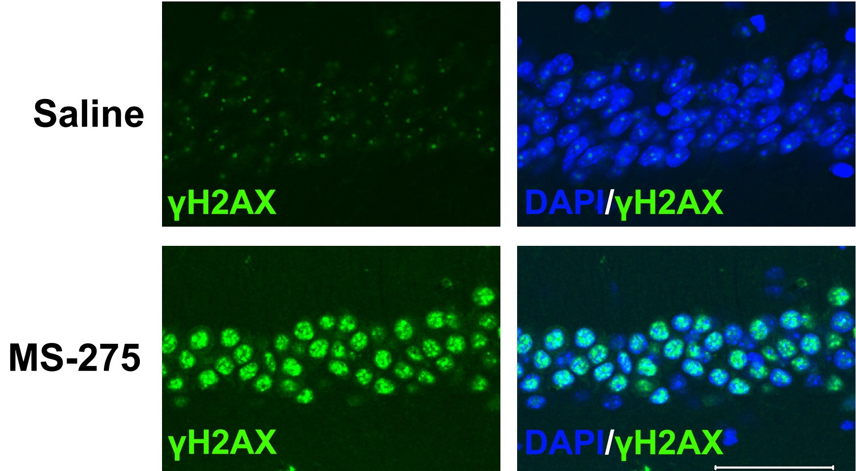 Four panels in a 2 by 2 grid show cells stained in different colors to denote the presence of DNA double-stranded breaks