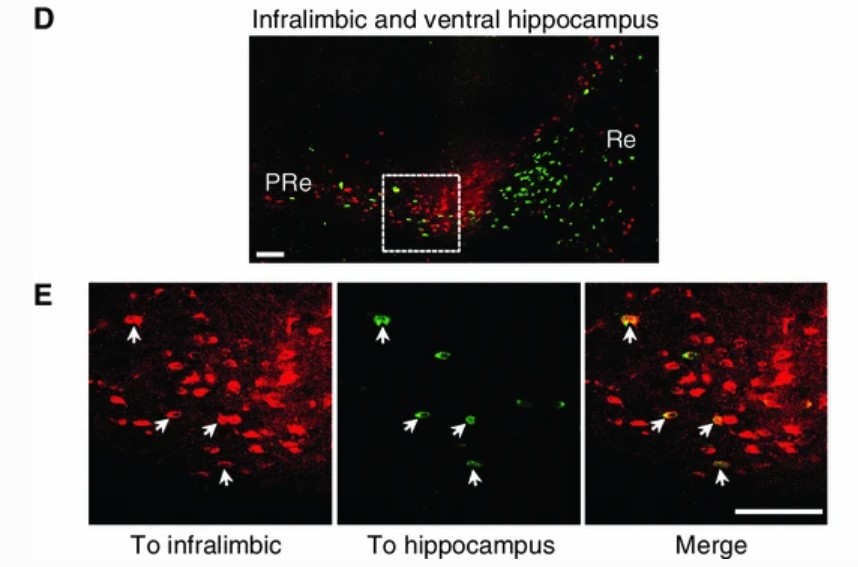 Four black panels show  red-stained cells. 