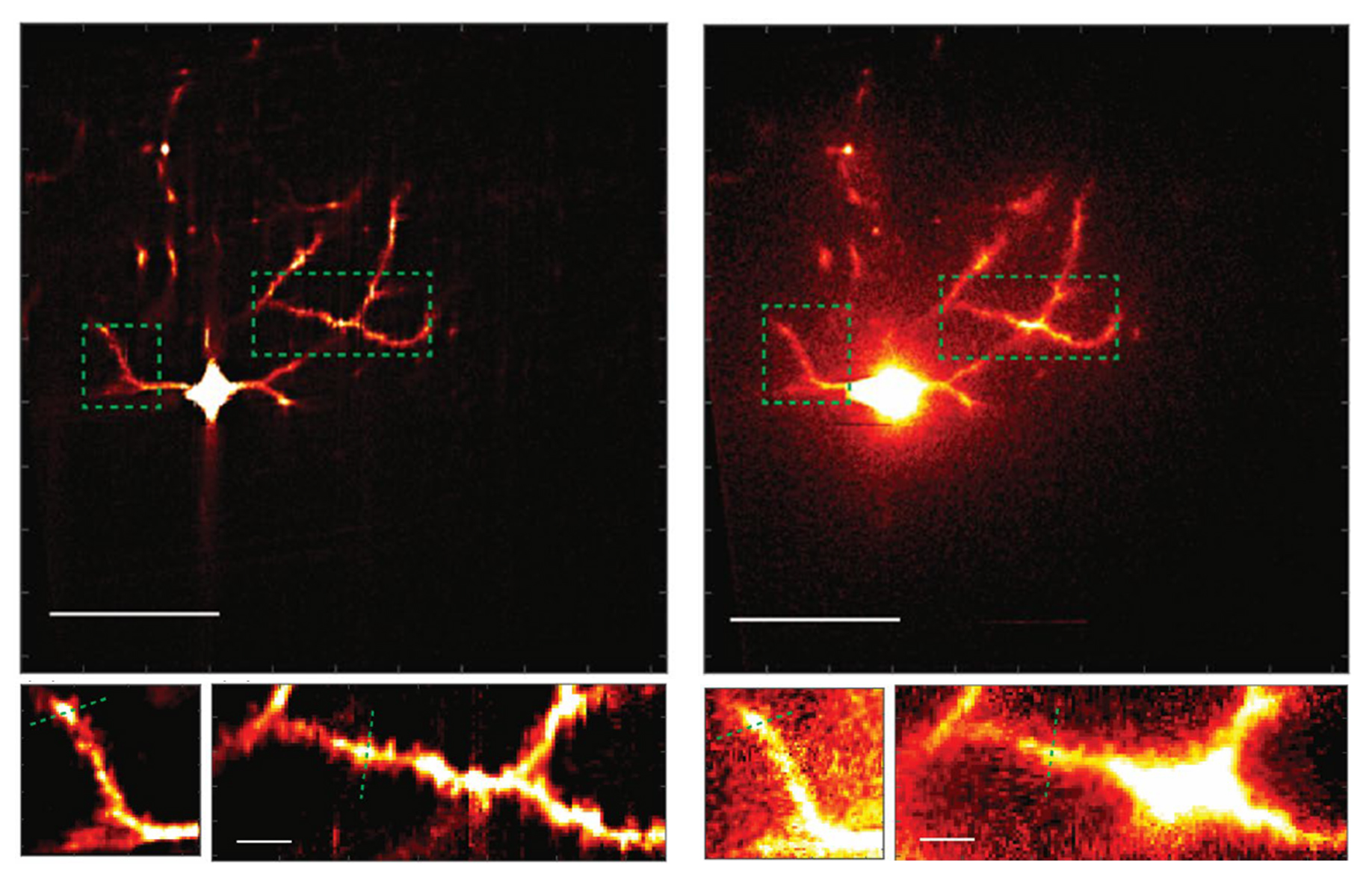 Four panels show a neuron glowing in red and yellow. The top left panel shows a neurn looing pretty sharp. Below that are zoomed in sections also looking detailed. On the right is a neuron that looks hazy. Below that are zoomed in sections that are also clouded.