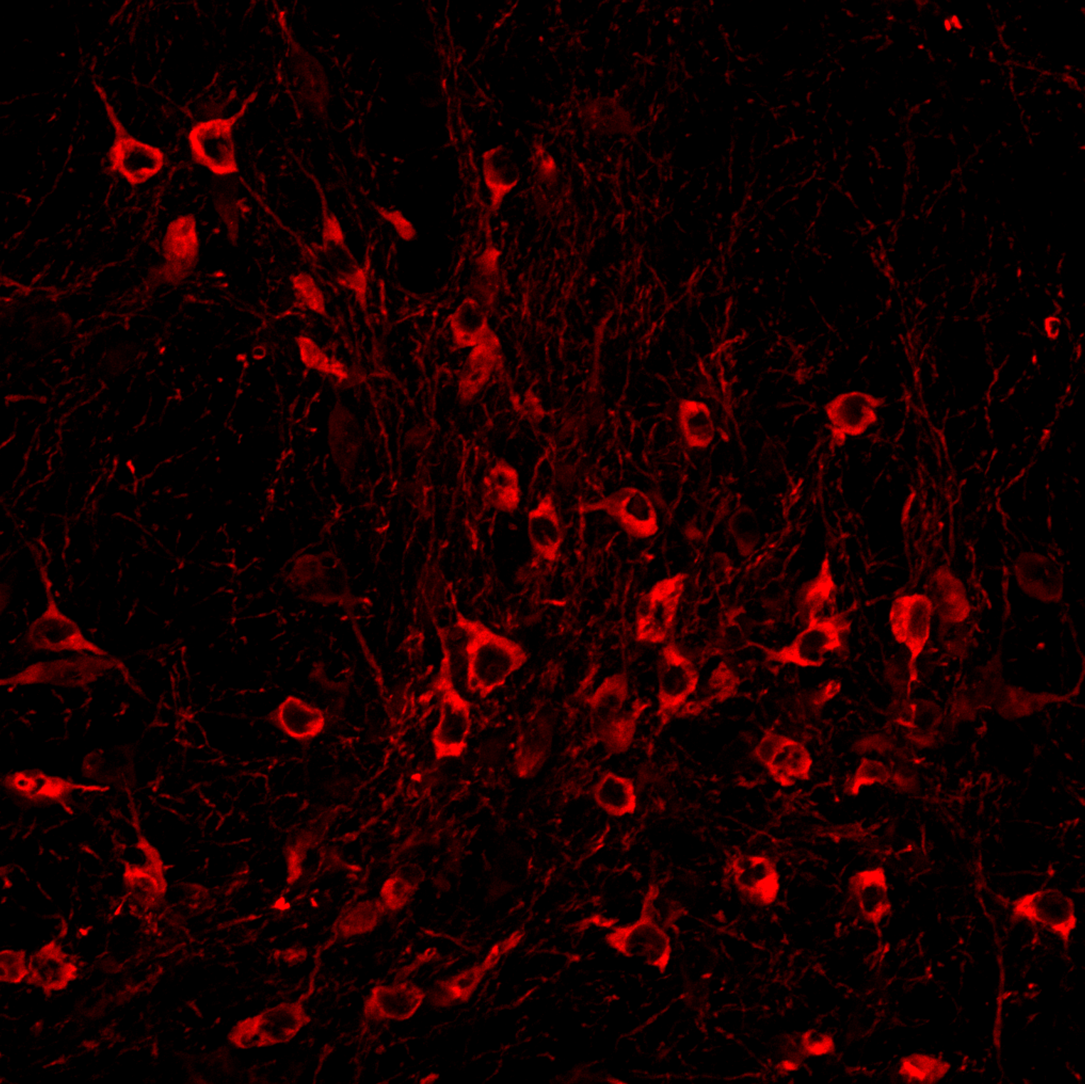 Reddish stained cells appear sprinkled over a black background