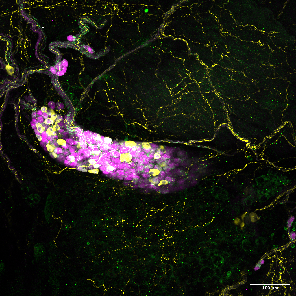 A finger-shaped magenta mass with bright yellow spots is atop a black background with lots of green marbling.