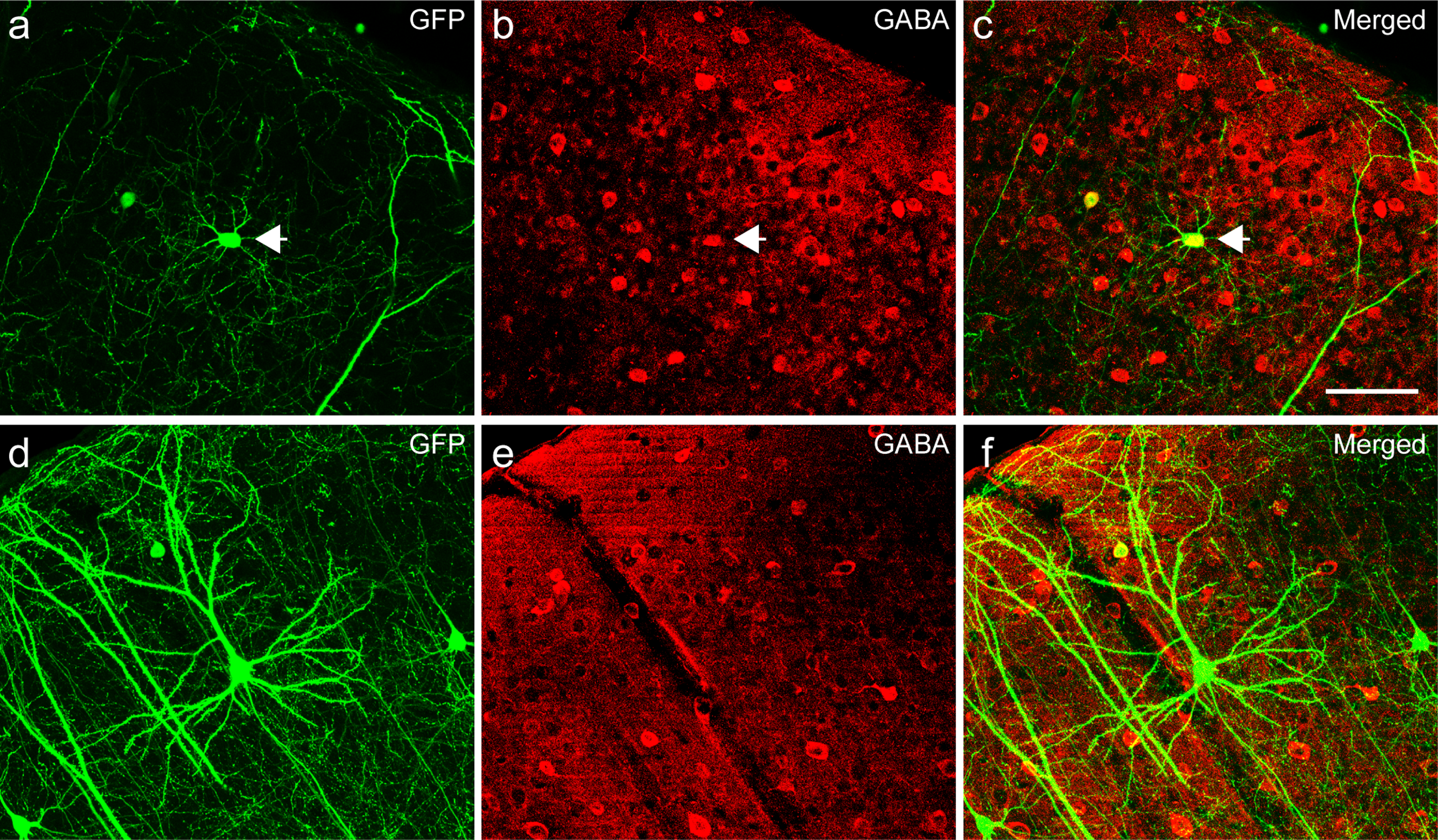 Six panels show neurons stained in green or red colors to inidicae the presence of GABA, an inhibitory neurotransmitter