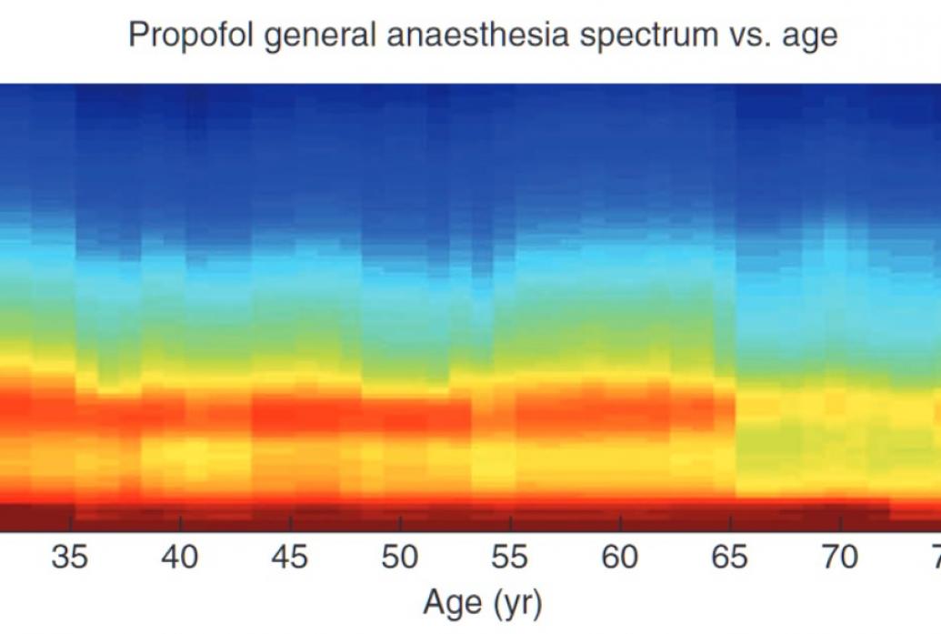 A horizontally oriented plot compares frequency vs. age using color warmth to indicate power. The warmer colors decline in height (frequency) with age.