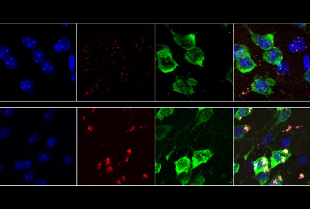 Neurons from mice aged 19 months (bottom row) show much higher rates of oxidative stress than neurons from 9-week-old mice (top row). Lipofuscin, a molecule associated with aging-related oxidative stress, appears red