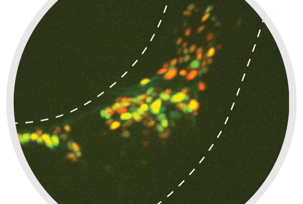 Neurons in a portion of a nematode worm glow in a microscope image on a black background