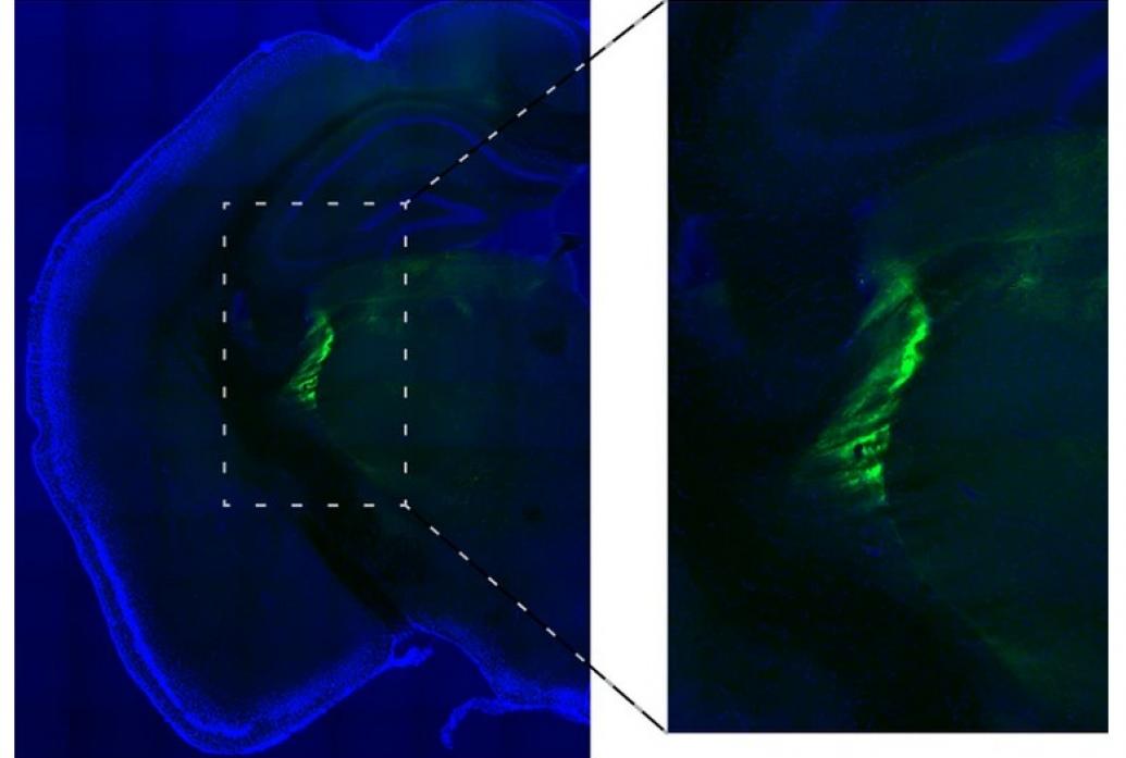 Two panels show a large blue area of brain tissue with a green stain in the middle. The green stain is enlarged ont he wright showing where an experimental injection occurred.