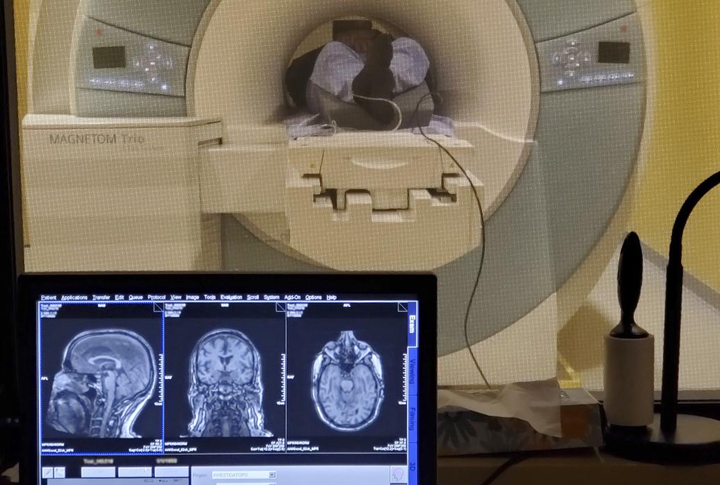 In the foreground there is a monitor showing brain anatomy scans. Behind that is a window looking upon an MRI scanner. We see a person's feet in the scanner's tube.