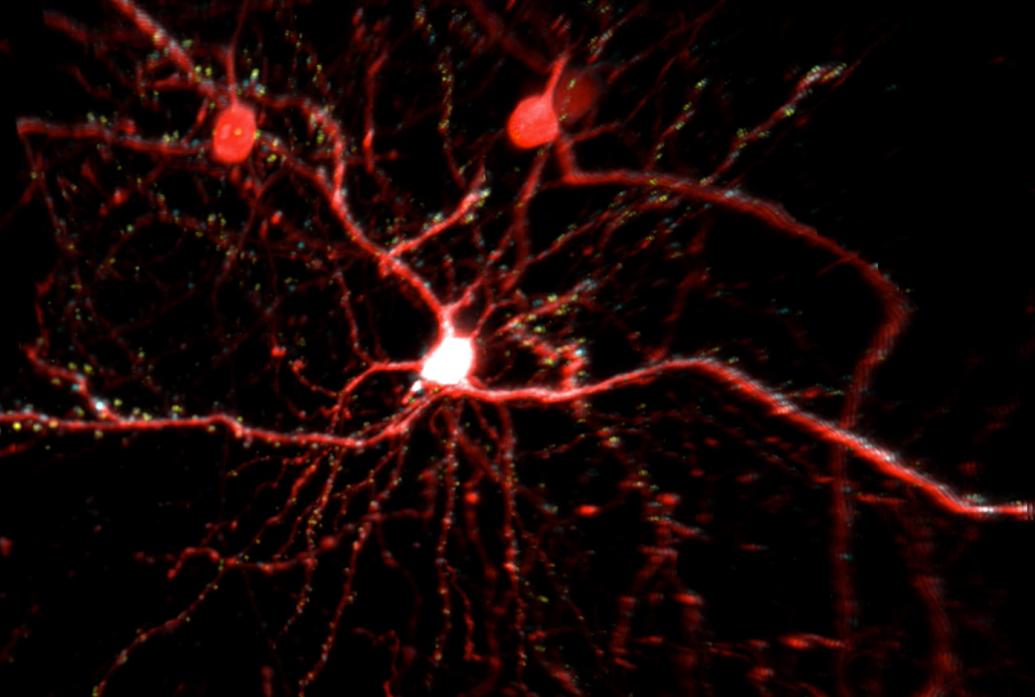 A neuron shows synapses of different colors