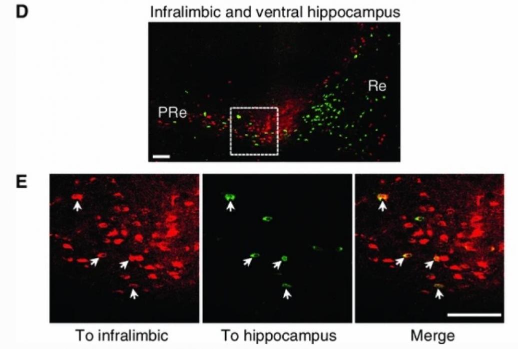 Four black panels show  red-stained cells. 