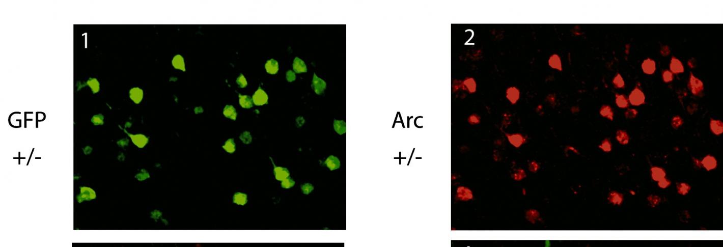 In four panels we see neurons on a black background stained in red, green or yellow colors.