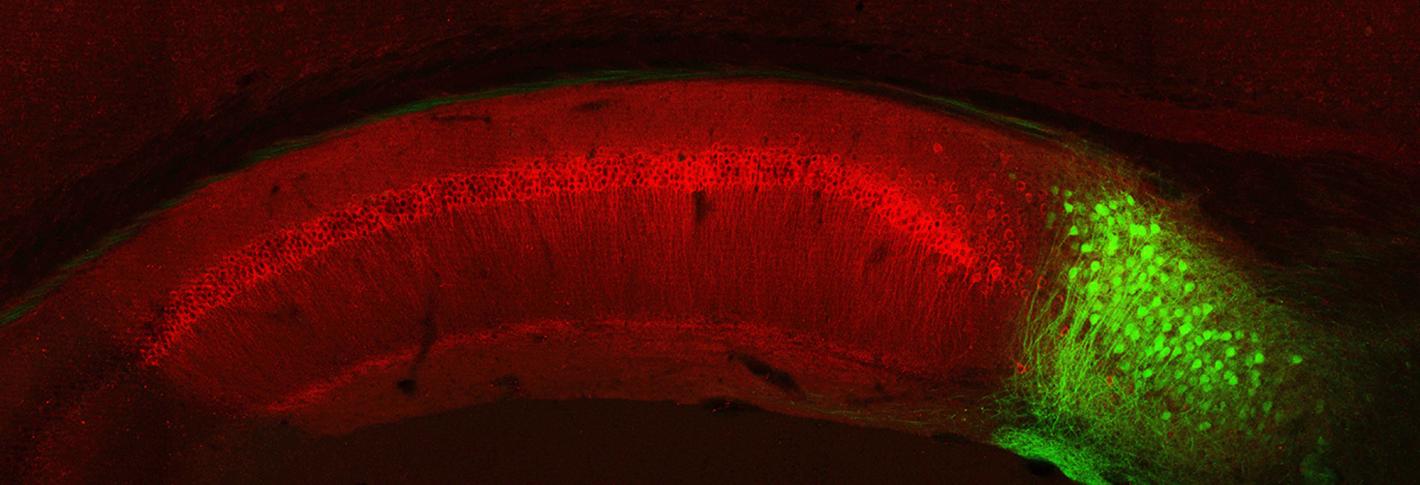 Subiculum