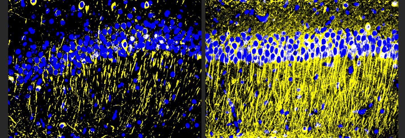 Two square panels side by side show a stripe of many blue dots near the top. The panel on the left has a few yellow stripes extending down from the blue dots. The panel on the right has many more of the yellow vertical lines.