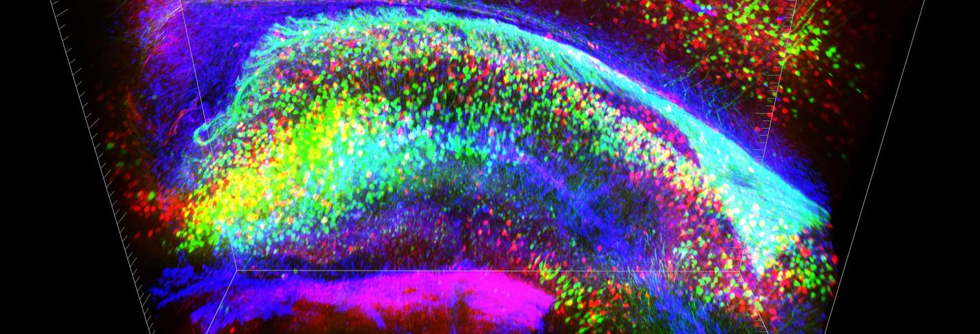 A clarified brain with many different types of cells stained different colors