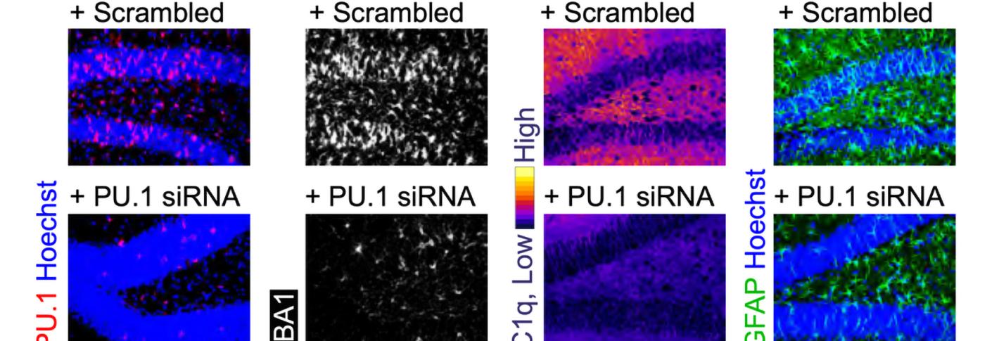 A 4x2 set of eight panels show highly colorful tissues. The bottom row is labeled siRNA while the top is a "scrambled' control. The various colored stains for inflammatory proteins are brighter in the top row than the bottom row.