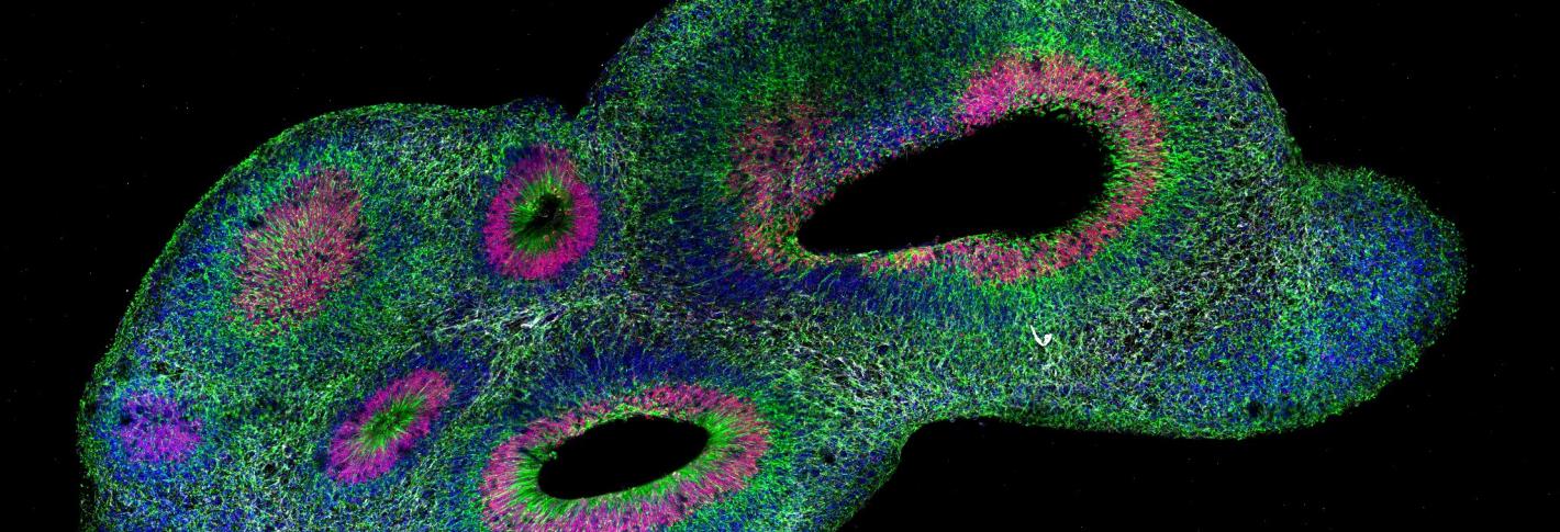 An organoid appears as an elongated, colorful, blob shape with large oblong holes in a few places