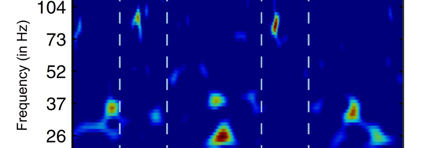 A chart from a study plots bursts of brain waves of varying frequency at specific times. The bursts are represented as warm colors against a the blue background. When there are low frequency bursts there aren't high frequency bursts and vice versa. 