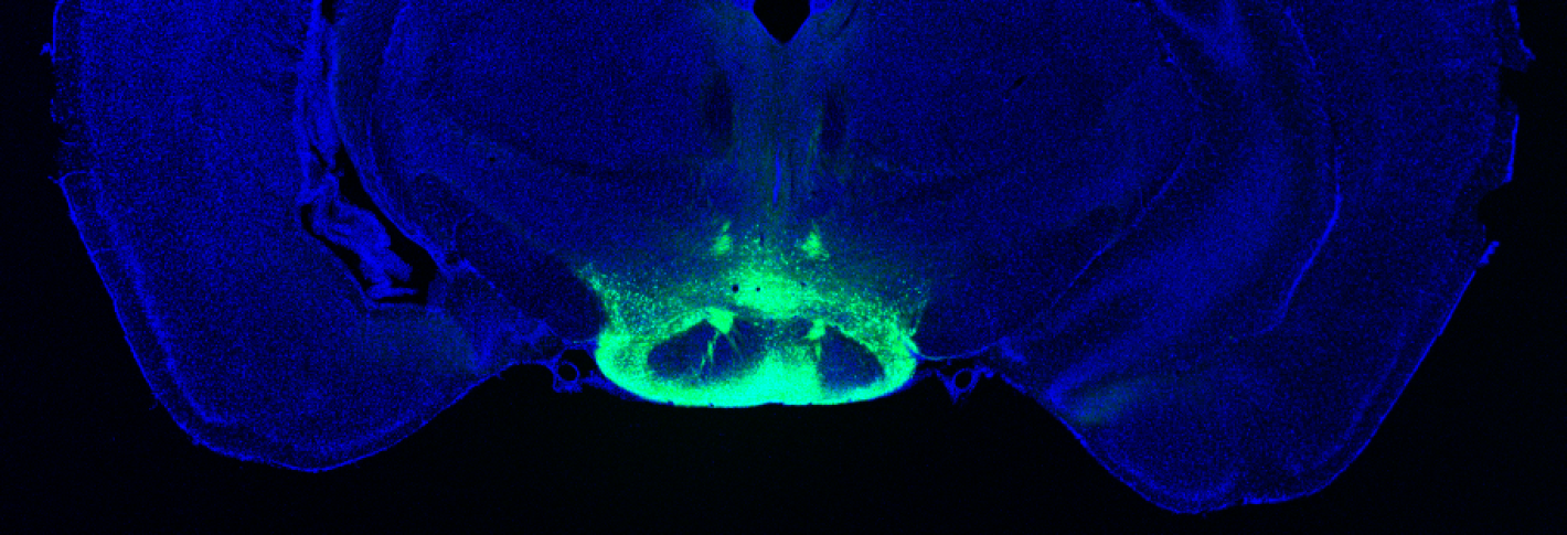 A mouse brain cross section (ear to ear) is stained in blue. At the very bottom center a squat, oval shaped structure is highlighted in a light breen hue