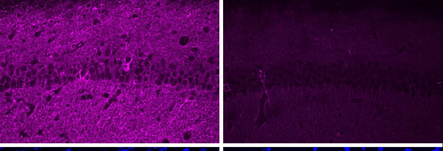 Four panels in a 2x2 array. The top left shows a lot of purple staining of cells. The top right shows much less purple. The bottom row shows two nearly idential stripes of blue with lots of blue spots above and below.