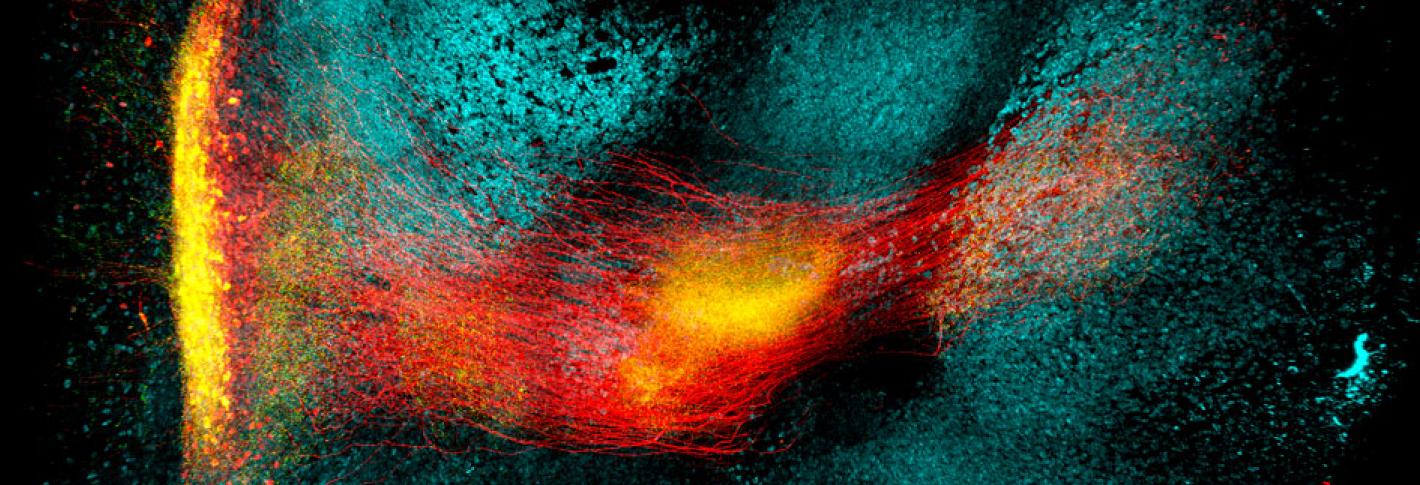 In the globus pallidus externa neurons that express a protein called parvalbumin are labeled in red, and neurons labeled blue express a protein called GAD1.