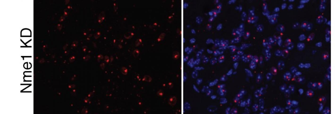 A 2x2 grid of microscop images shows red speckles overlaid on blue blobs. The blue indicates cells. The red indicates aggregated proteins. Where a gene called NME has been knocked down, there are more red speckles on the cells.