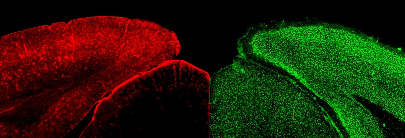 The mouse visual cortex with astrocytes stained red on the left and neurons stained green on the right.