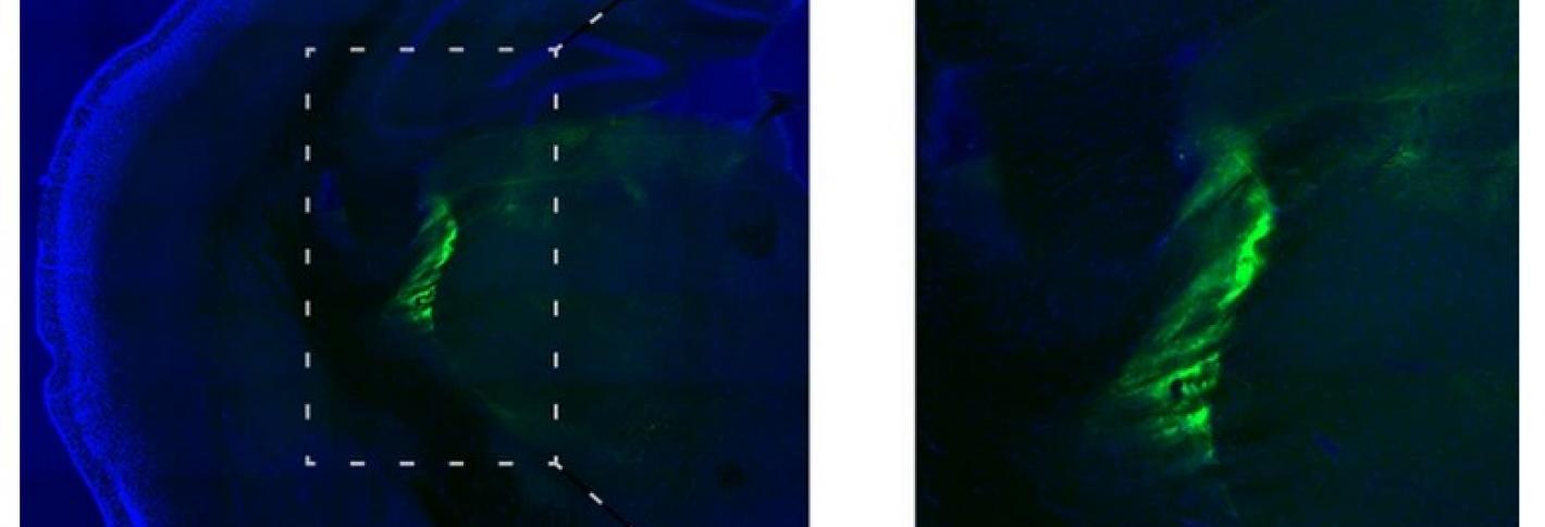 Two panels show a large blue area of brain tissue with a green stain in the middle. The green stain is enlarged ont he wright showing where an experimental injection occurred.