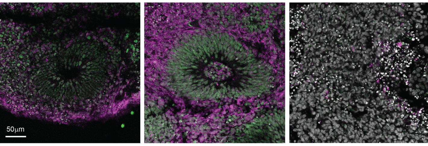 Three panels show magenta- and green-stained cells in organoids.