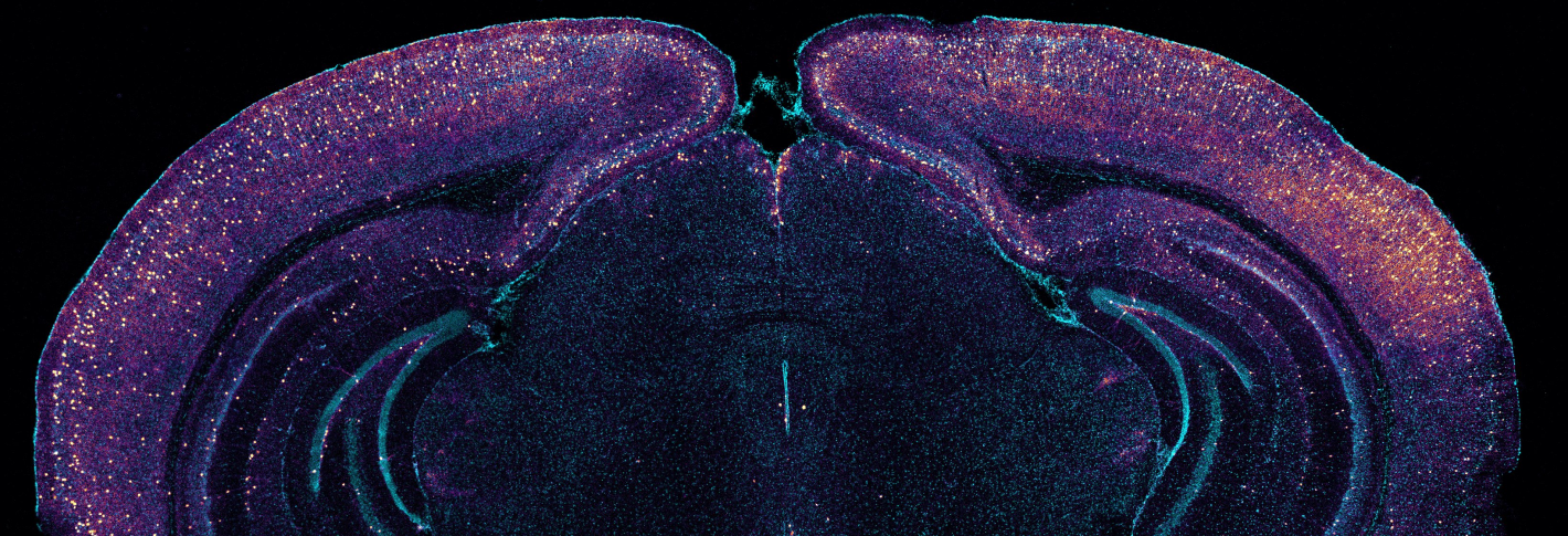 A coronal cross-section of a mouse brain is stained blue. The entire outer edge and occasional points further inside are speckled with yellow-green dots. The background behind the brain is black.