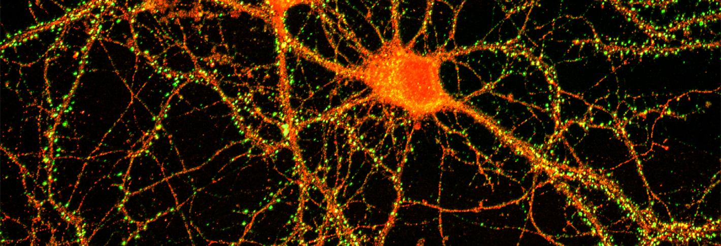 Two neurons next to one another (red)